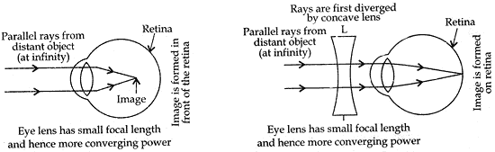 ray diagram to illustrate