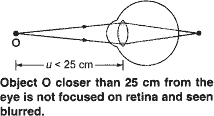 Why is a normal eye not able to see clearly the objects placed closer