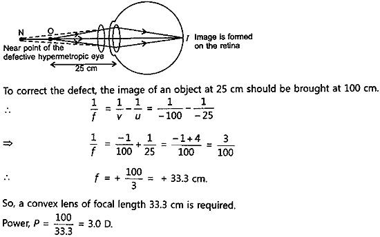 Make a diagram to show how hypermetropia is corrected